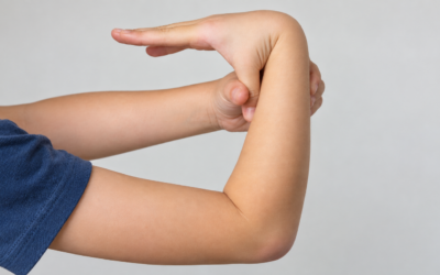 Hiperlaxitud en niños: ¿cuándo debemos preocuparnos?